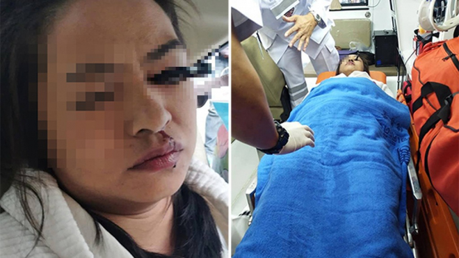 Neštěstí této dámy důrazně připomíná, že líčení do auta nepatří. Ani když neřídíte